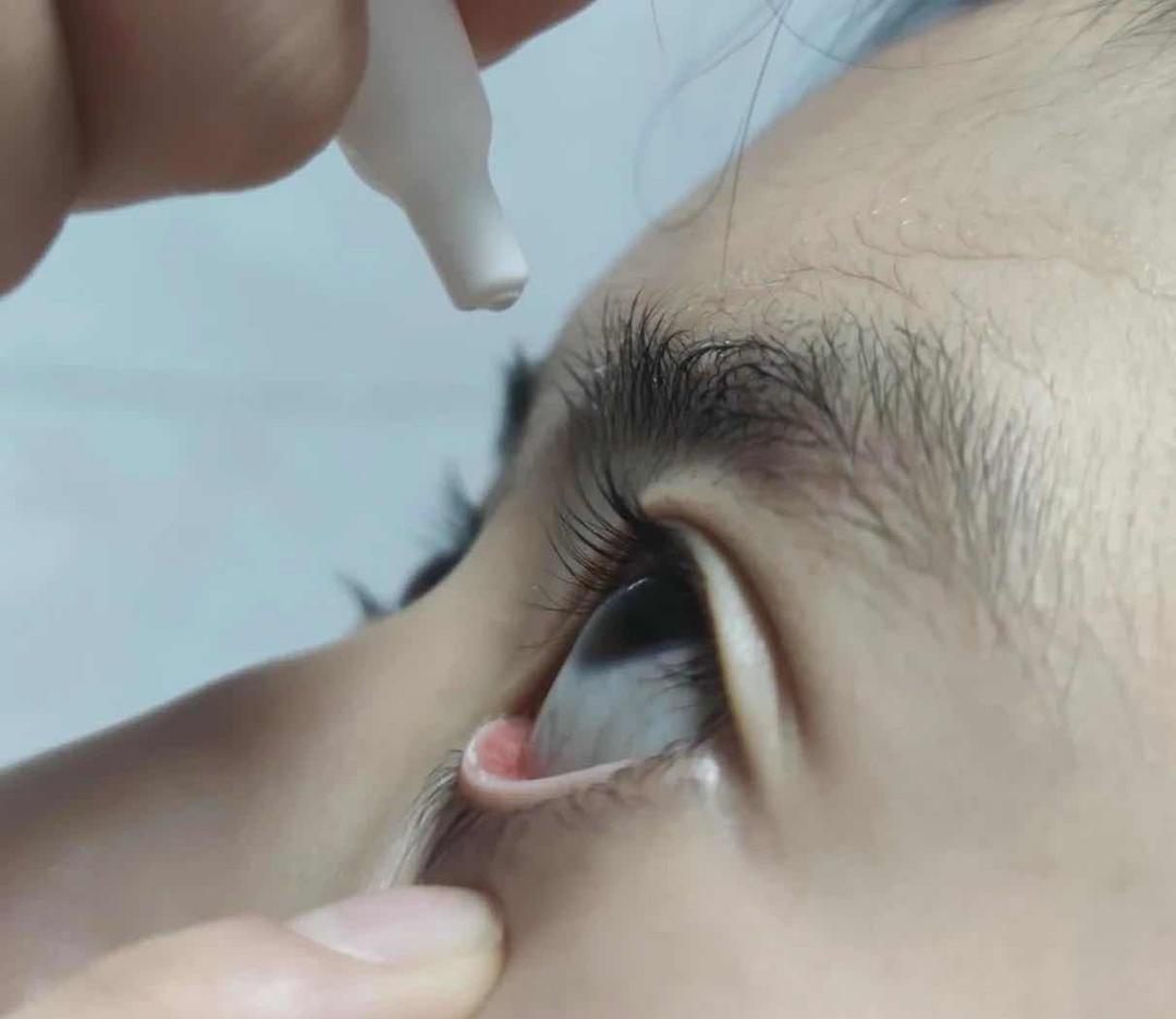 ��ҩˮ��ֱ�ӵ�������������ȷ�÷������۲�����