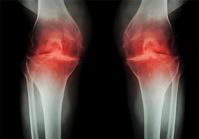 ��������ᰱ�������ǵ������빦Ч�Աȣ�Ӧ�Թǹؽ�����ξ���